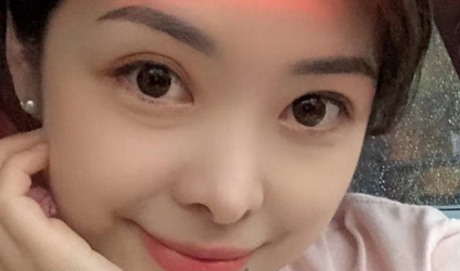 去眼袋手术