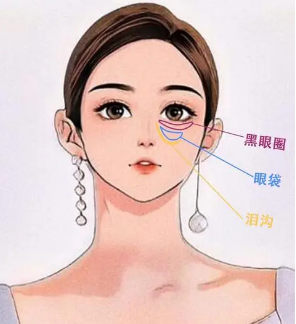 去眼袋手术