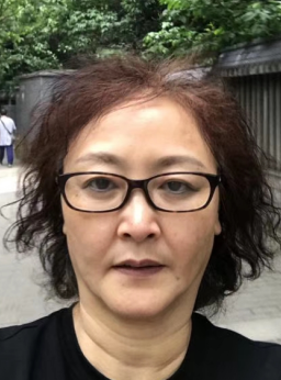 去眼袋手术