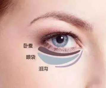 去眼袋手术
