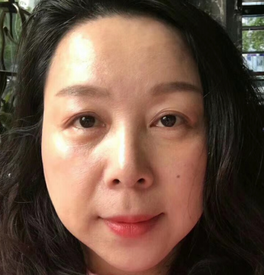 去眼袋手术