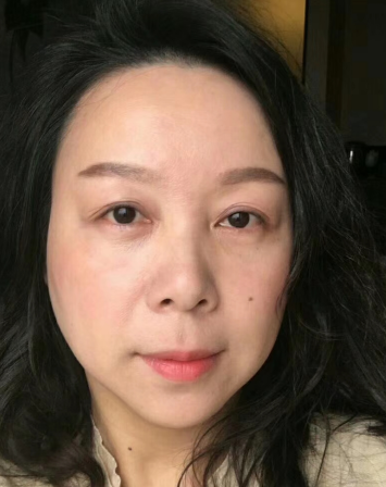 去眼袋手术