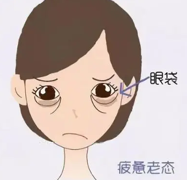 眼袋
