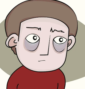 眼袋