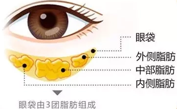 去眼袋手术