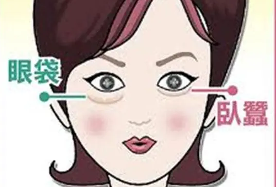 去眼袋手术