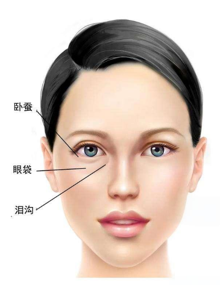 去眼袋手术