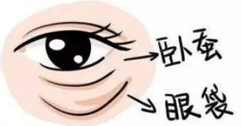 去眼袋手术