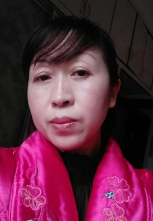 去眼袋手术