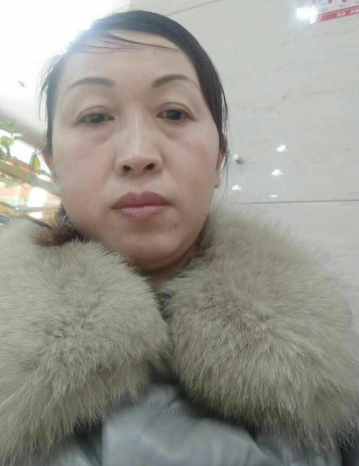 去眼袋手术