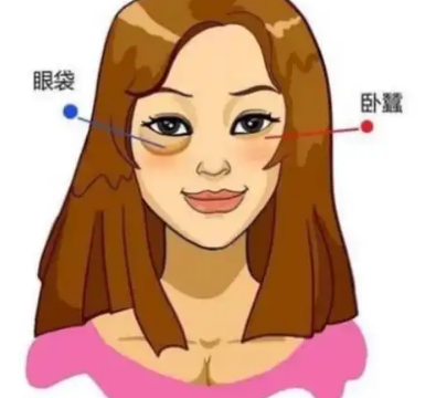 去眼袋手术