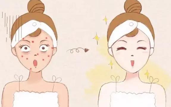去眼袋手术
