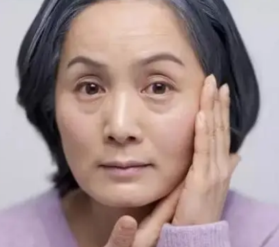 去眼袋手术