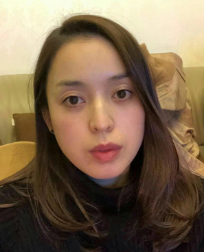 去眼袋手术