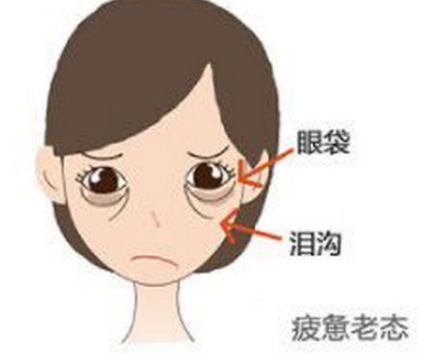 眼袋