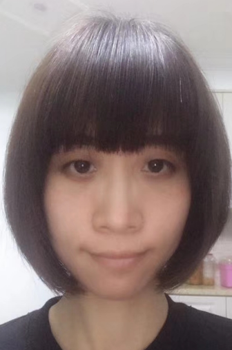 去眼袋手术
