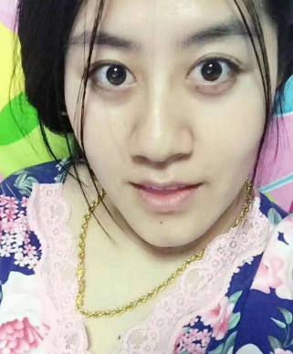 去眼袋手术
