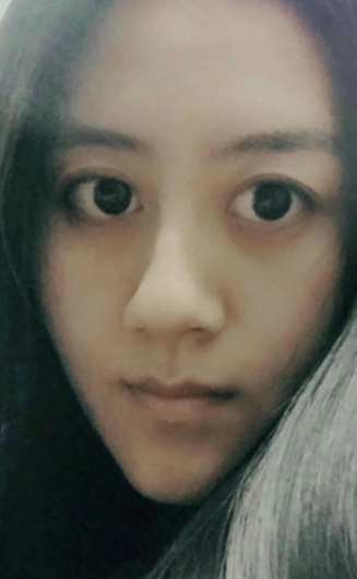 去眼袋手术