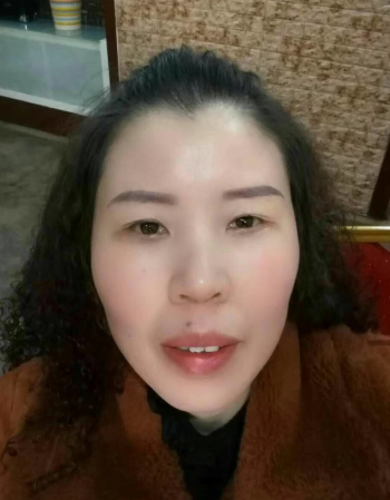 去眼袋手术