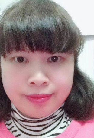 去眼袋手术