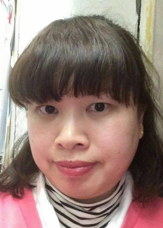 去眼袋手术