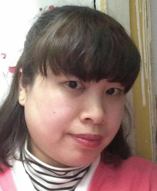 去眼袋手术