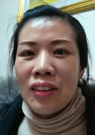 去眼袋手术