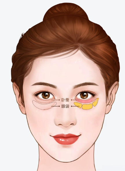 眼袋