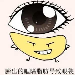 眼袋
