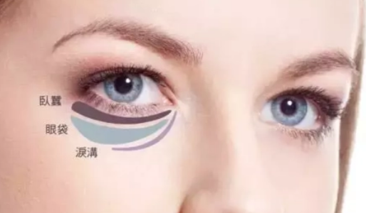 去眼袋手术
