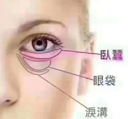 去眼袋手术