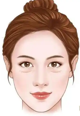去眼袋手术