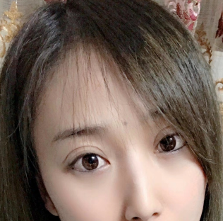 眼袋