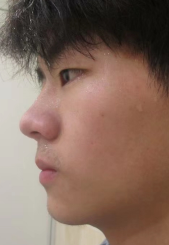 下巴