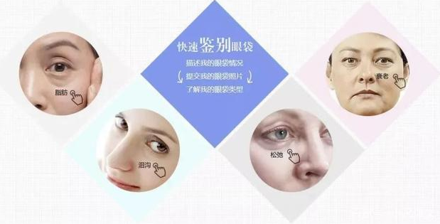 去眼袋手术