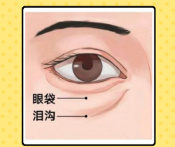 去眼袋手术
