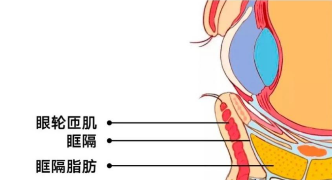 去眼袋手术