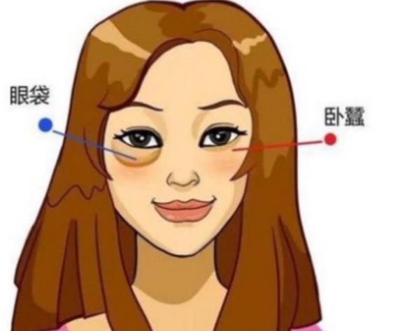 去眼袋手术