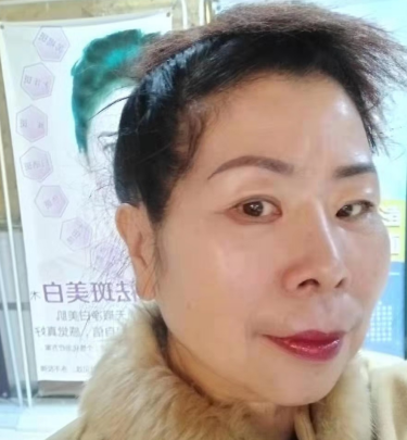去眼袋手术