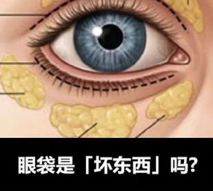 去眼袋手术