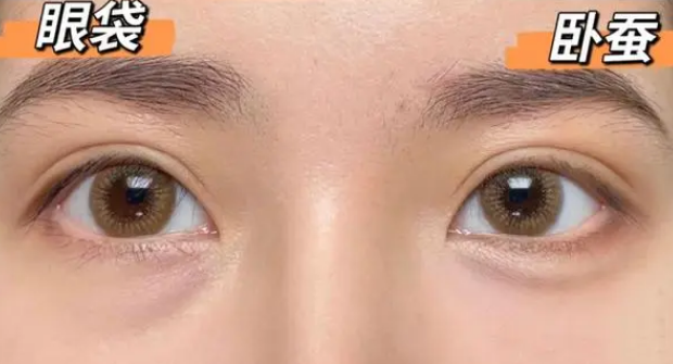 眼袋