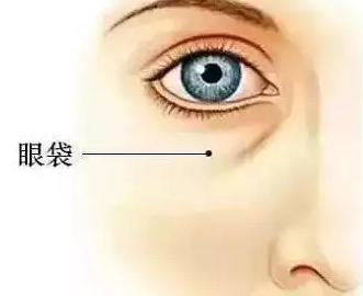 眼袋