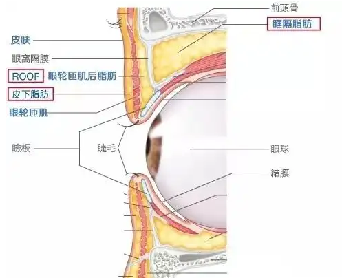 眼袋