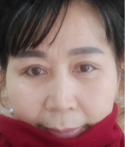 去眼袋