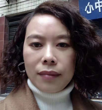 去眼袋手术