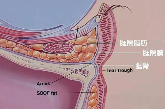 去眼袋手术