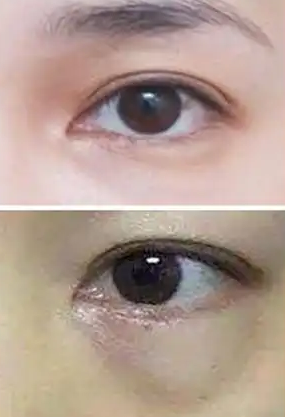 ۴