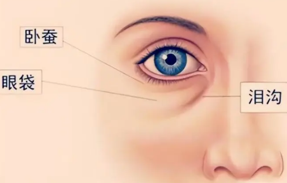 去眼袋手术