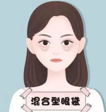 去眼袋