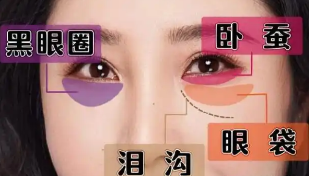 眼袋